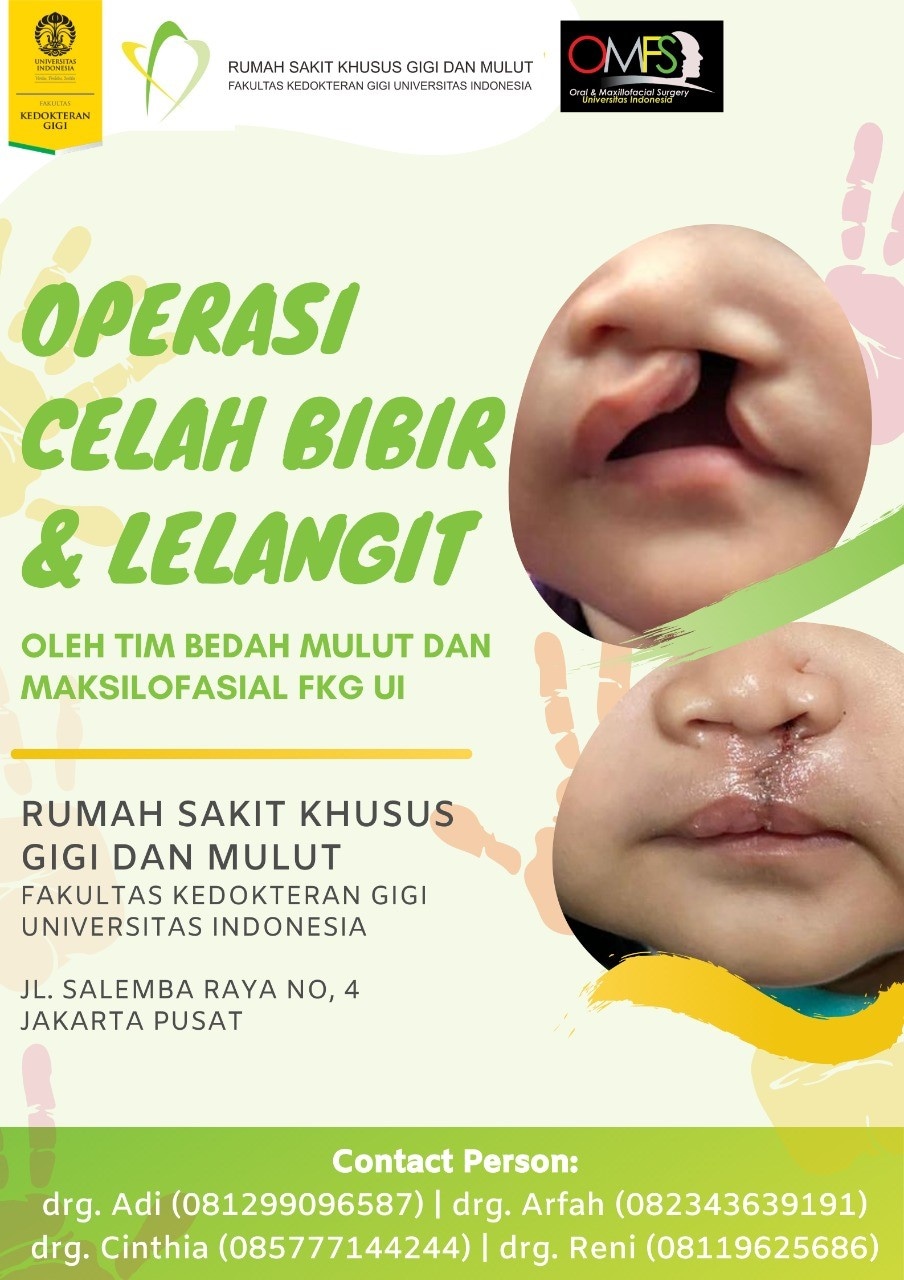 Departemen Bedah Mulut dan Maksilofasial FKG UI Gelar Operasi Celah Bibir Perdana