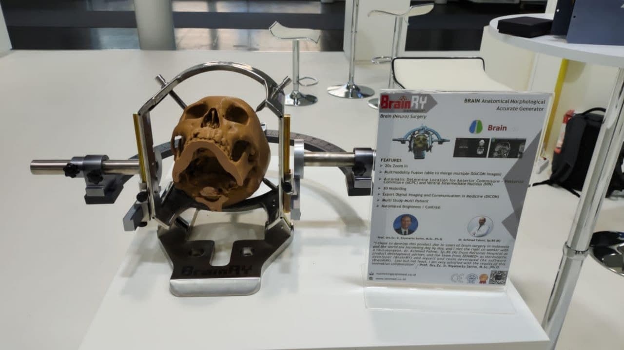 Profesor ITS Kembangkan Sistem Stereotaktik untuk Dukung Bedah Saraf Otak