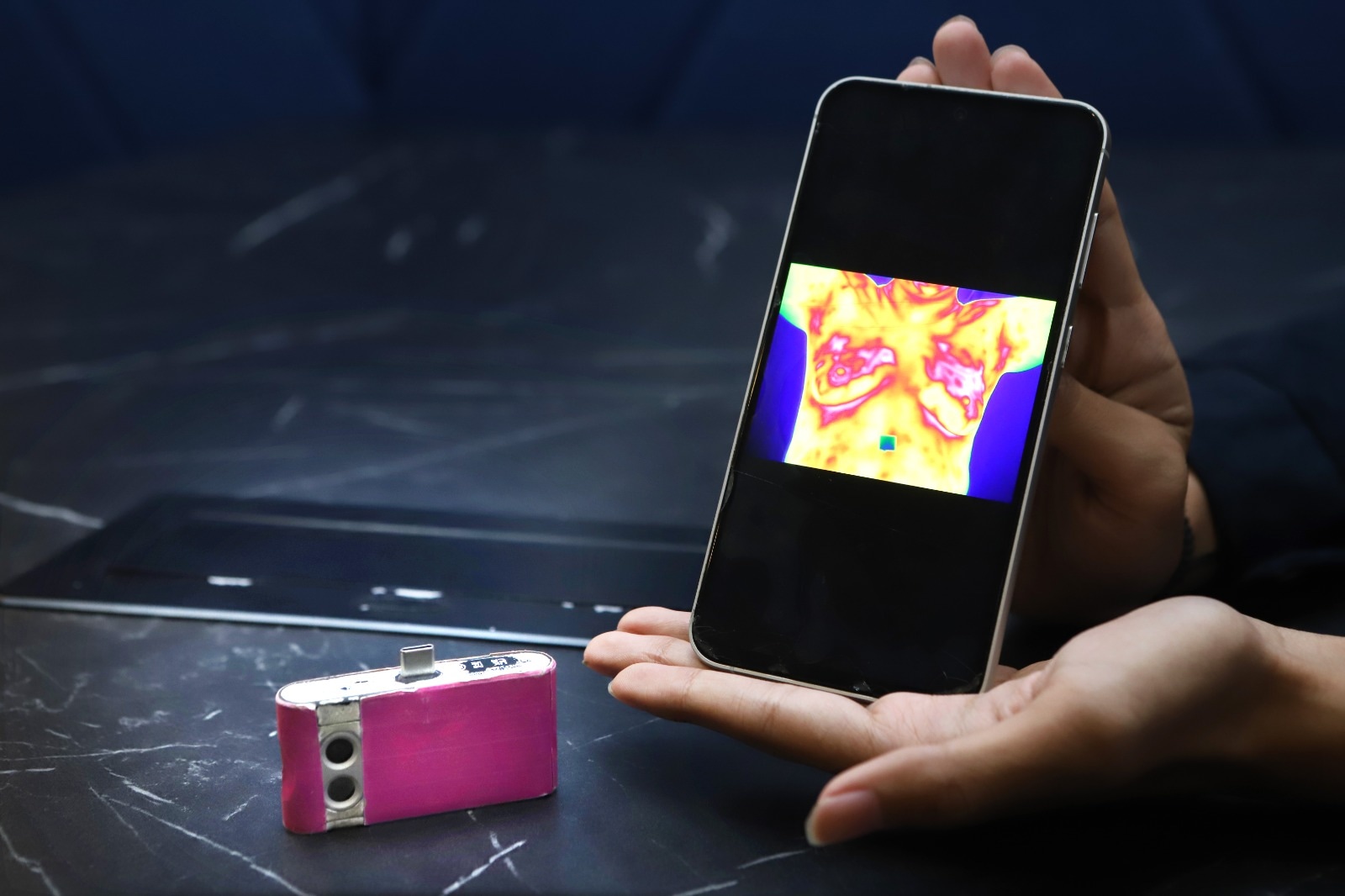 BUDDY, Inovasi Pendeteksi Kanker Payudara Karya Mahasiswa UB Raih Penghargaan Internasional